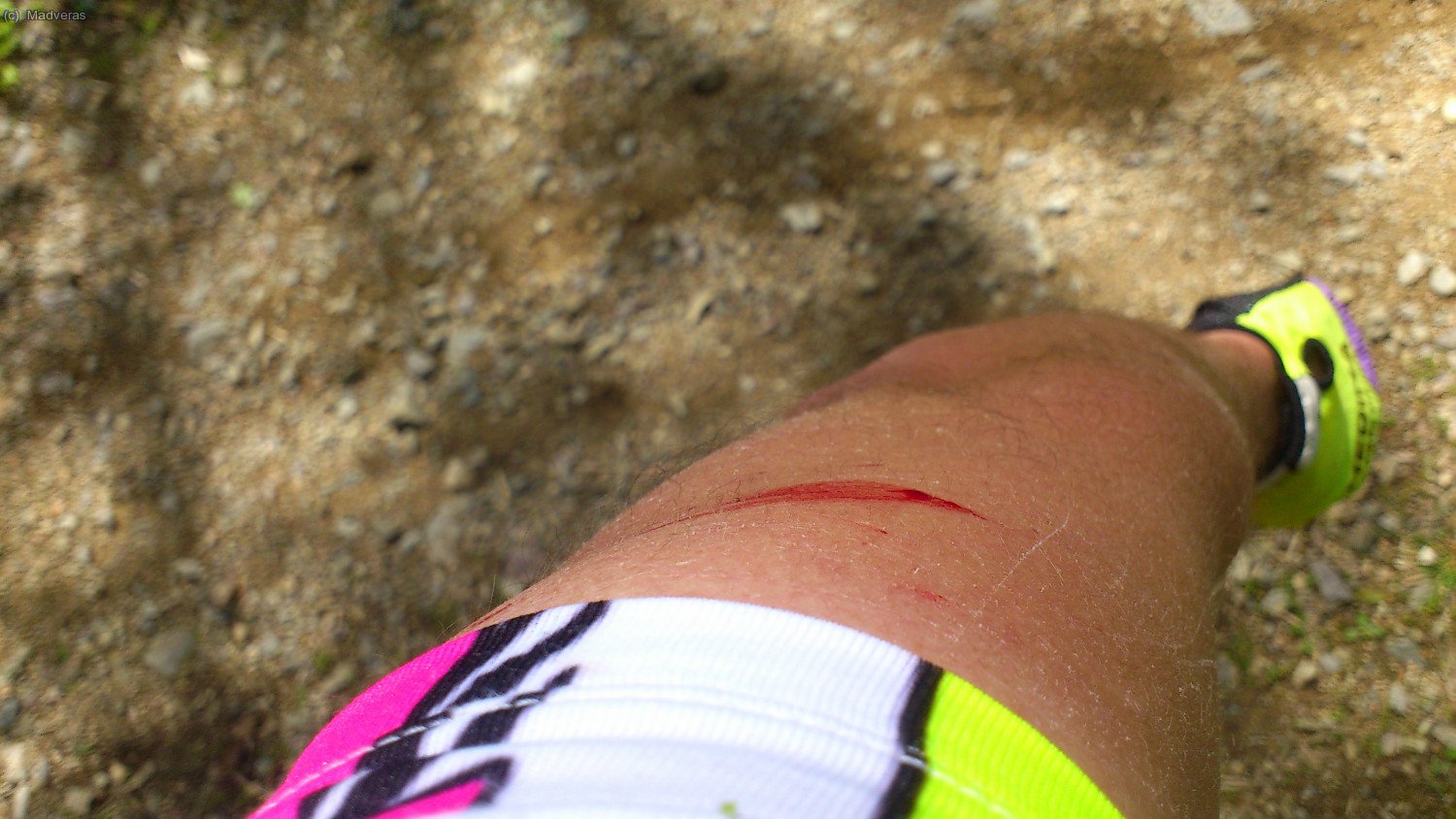 suant sang jajajajaja .... vam acabar plenisims d