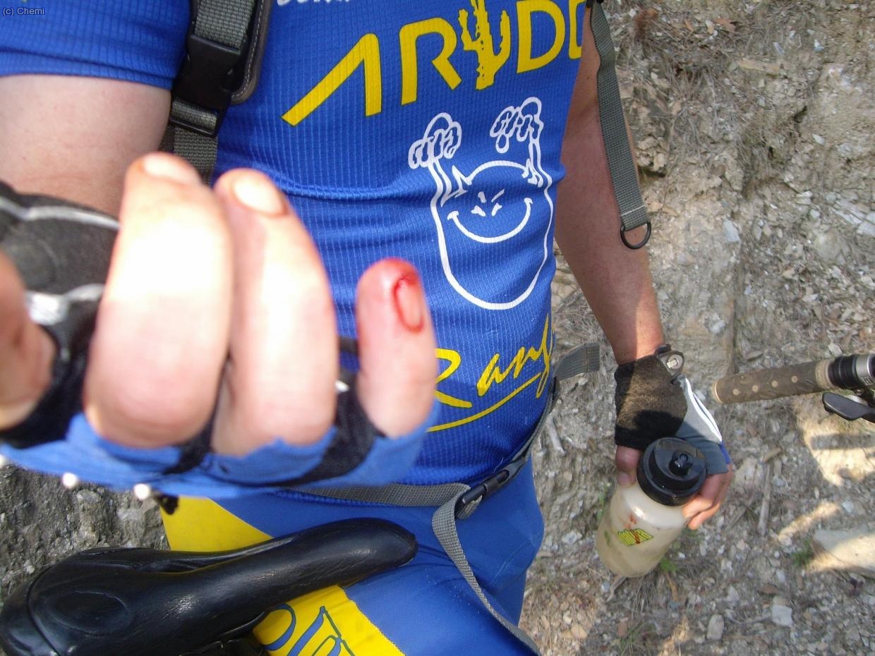 ... Y despu&eacute;s